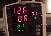 VS800 RESP NIBP SPO2 utilizó el monitor cardiaco de Mindray del monitor paciente